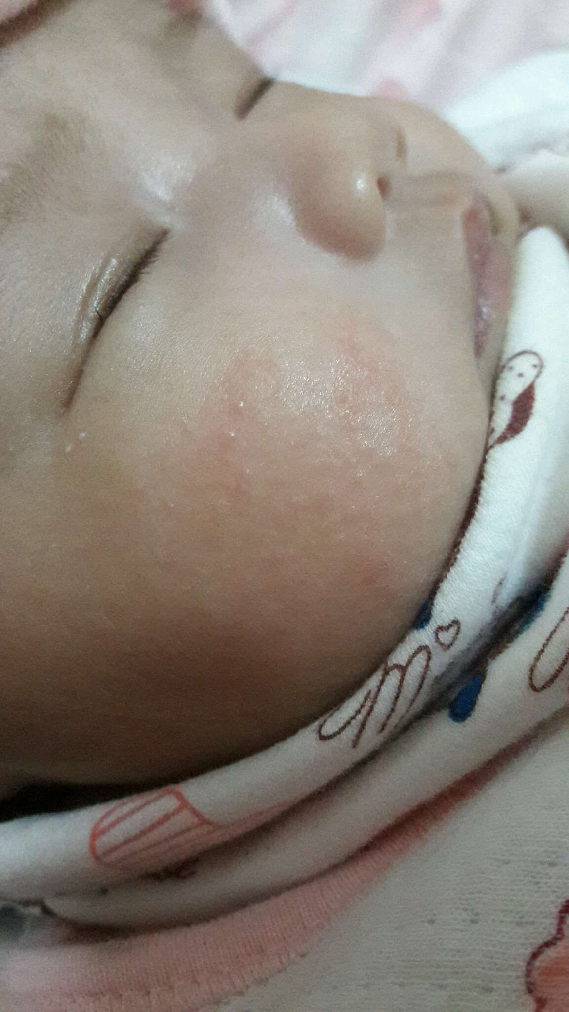 寶寶臉上的[油  垢 ]