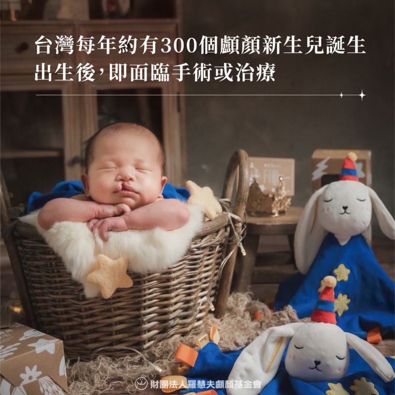 【羅慧夫顱顏基金會】魔法兔安撫巾愛心義賣