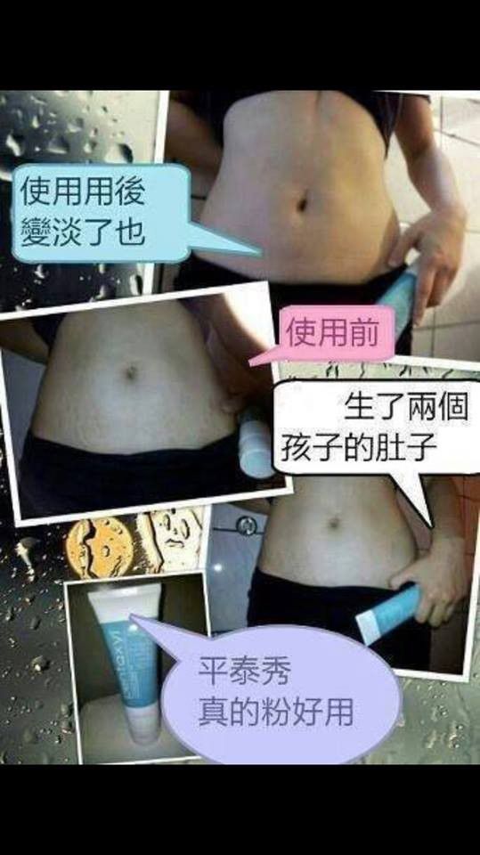 皺紋、妊娠紋、疤痕的橡皮擦---平泰秀