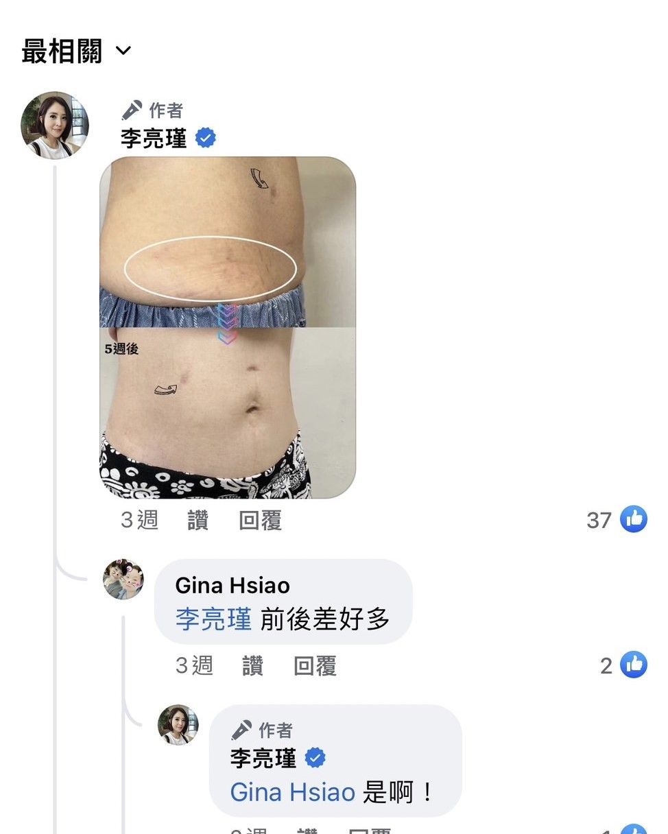 打精靈電波消除妊娠紋的效果好不好