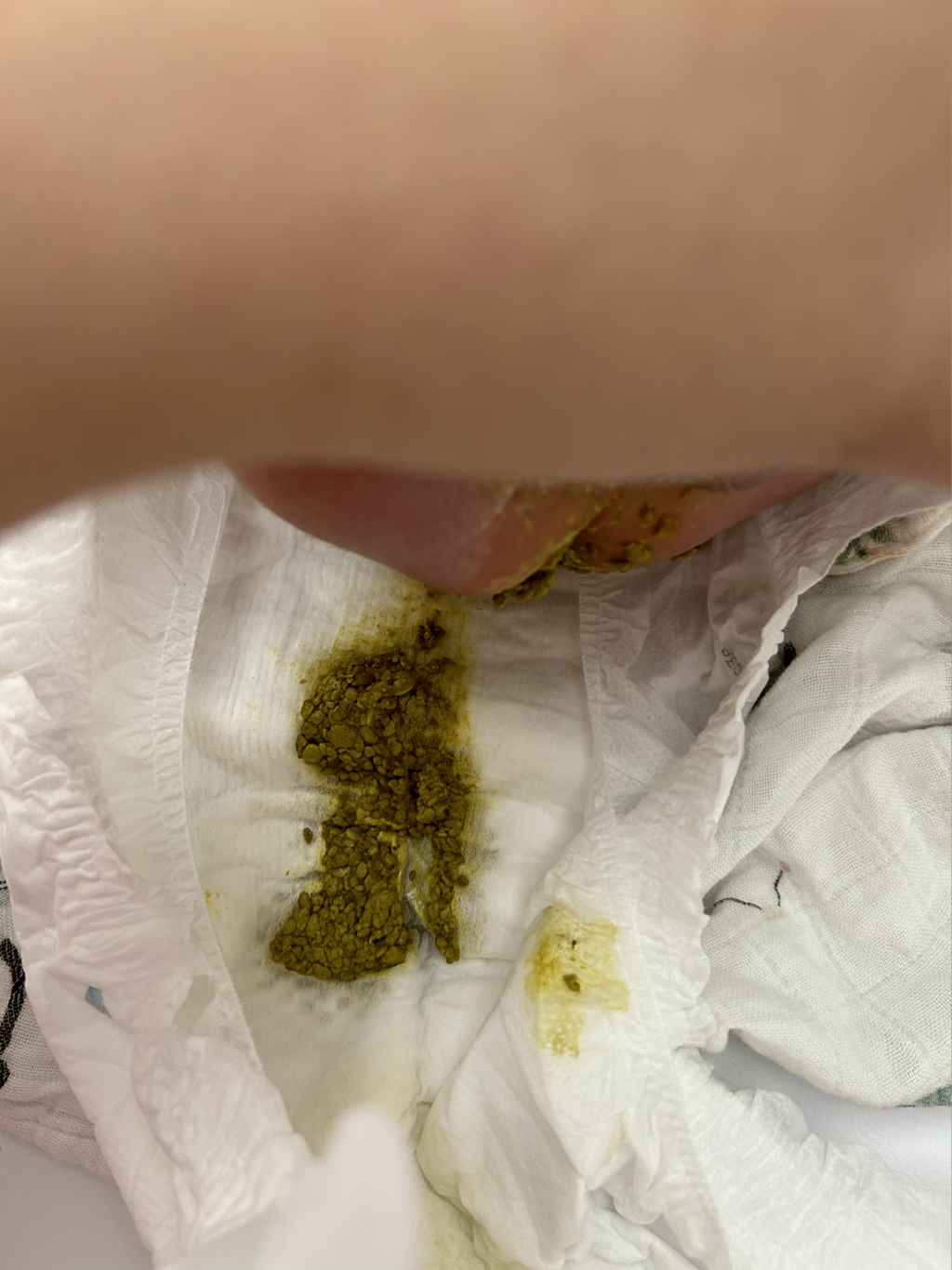 寶寶便便怎麼一粒一粒的 這要正常嗎（急問）