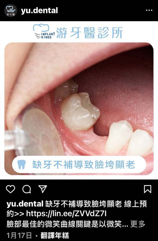 臉凹好困擾