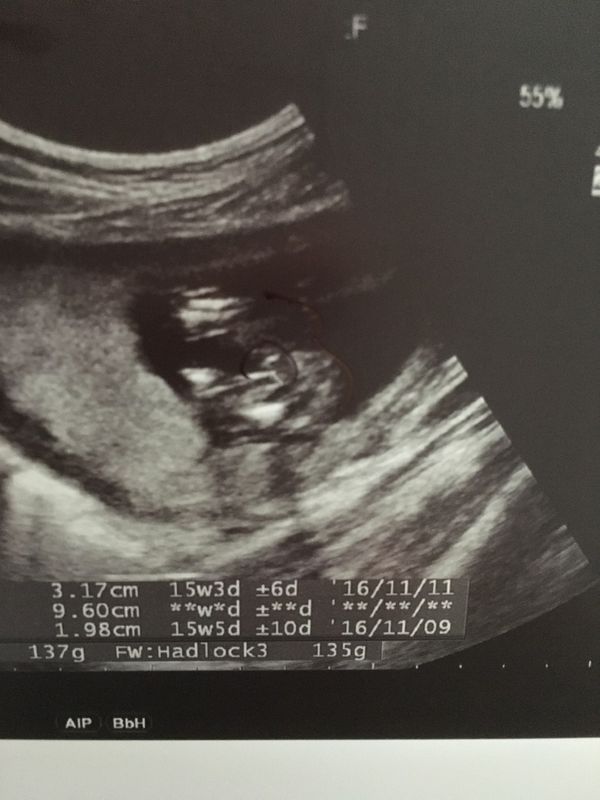 看得出寶寶的性別嗎 媽咪愛 育兒問答