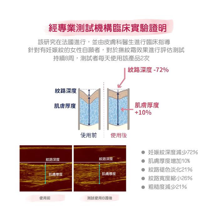 德國珊諾sanosan - S孕女神多胜肽緊緻撫紋霜-30ml