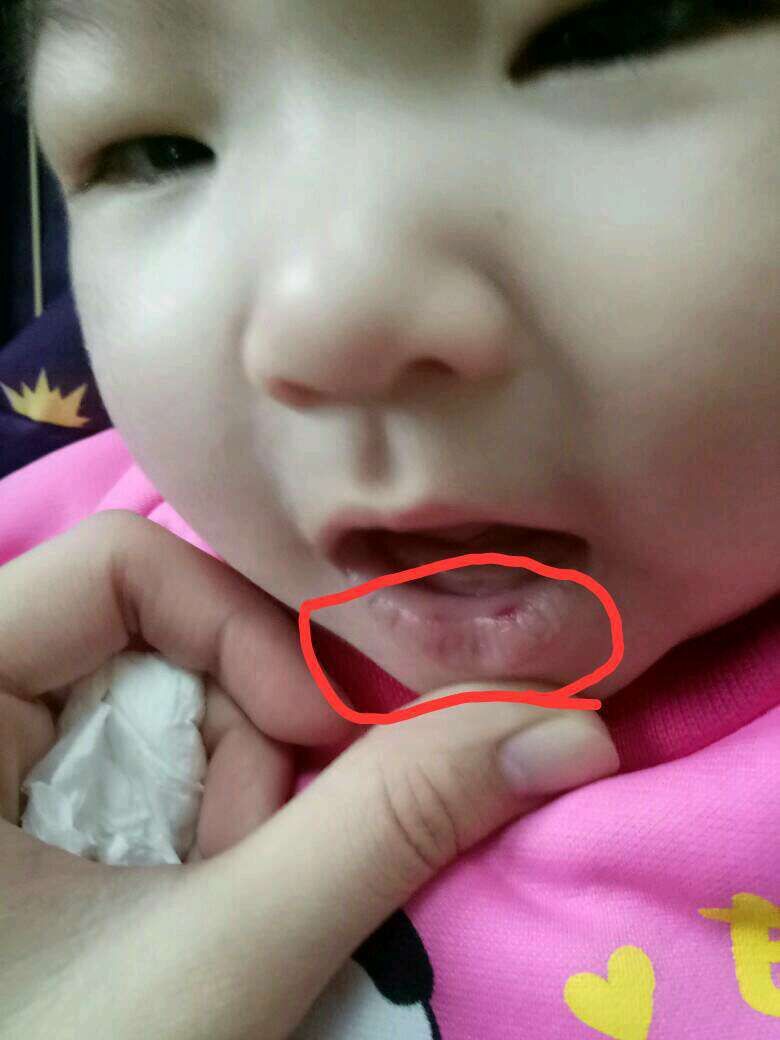 吸允下唇的壞習慣