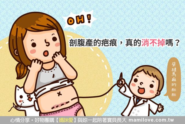 剖腹產的疤痕，真的消不掉嗎？