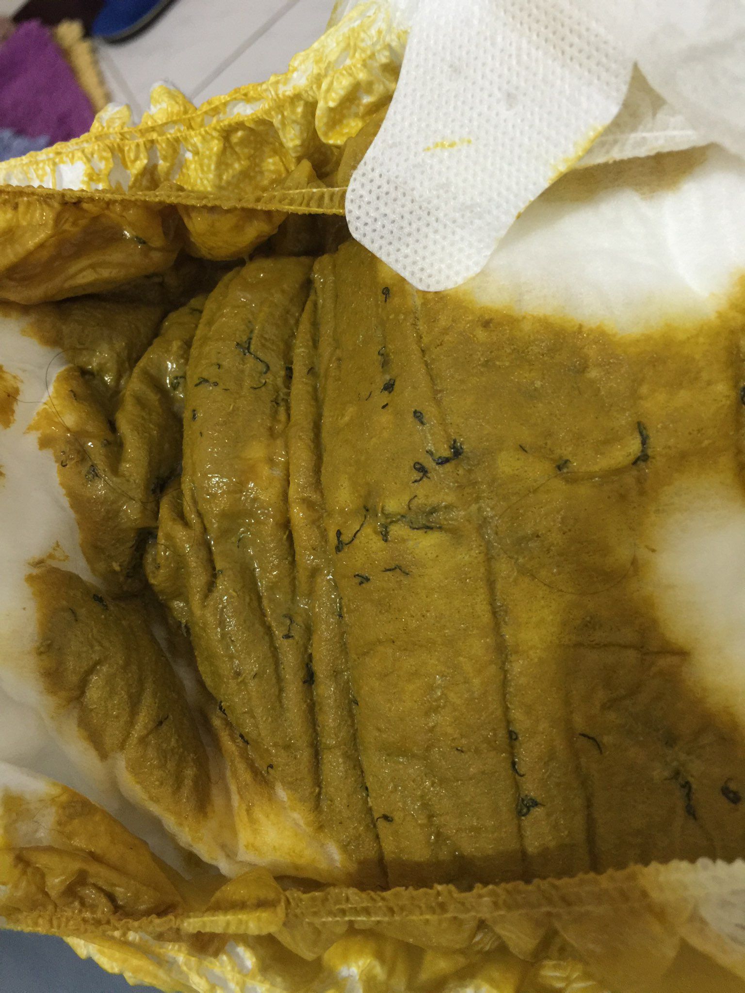 母奶混配方奶的排便