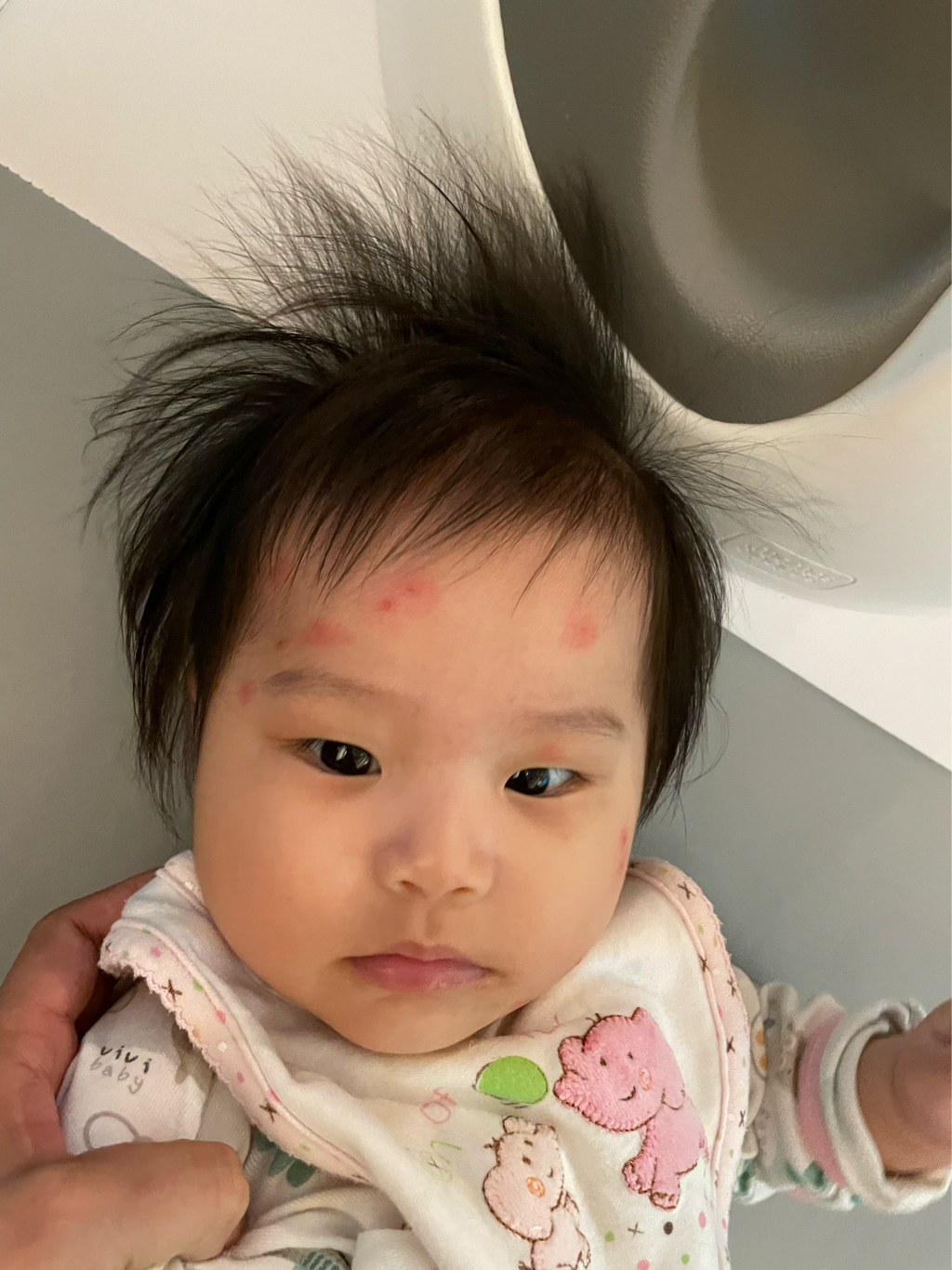 請問寶寶臉上像是被什麼蟲咬嗎？