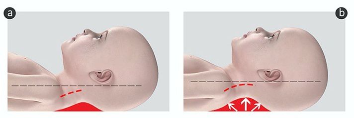 韓國 INUO - 3段可調式水洗枕-洞洞表面-太陽花 (45X33X5cm)-2歲以上適用