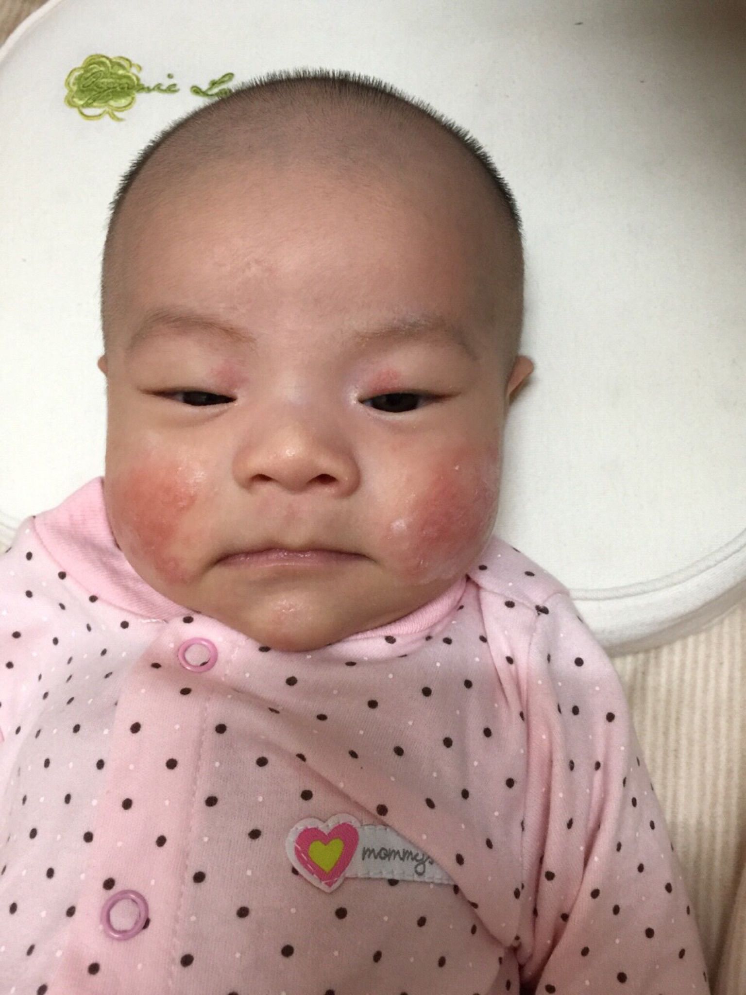 宝宝脸上总反复长红点点是怎么回事啊？还老爱用手揉眼睛 脸 - 百度宝宝知道