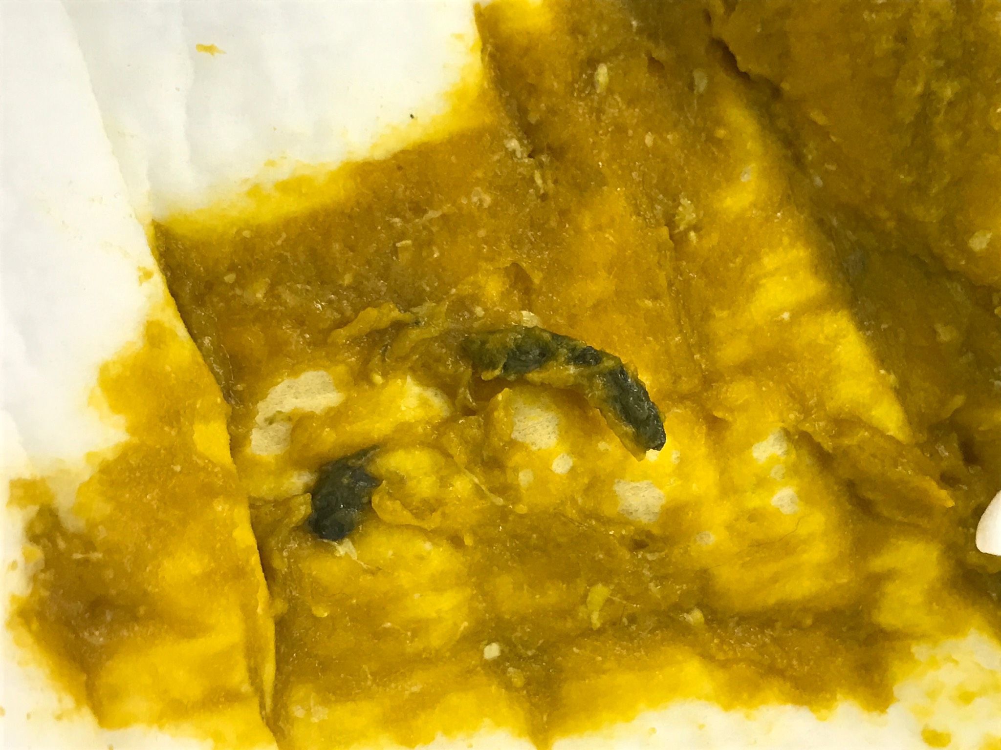 大便帶黑色條狀物