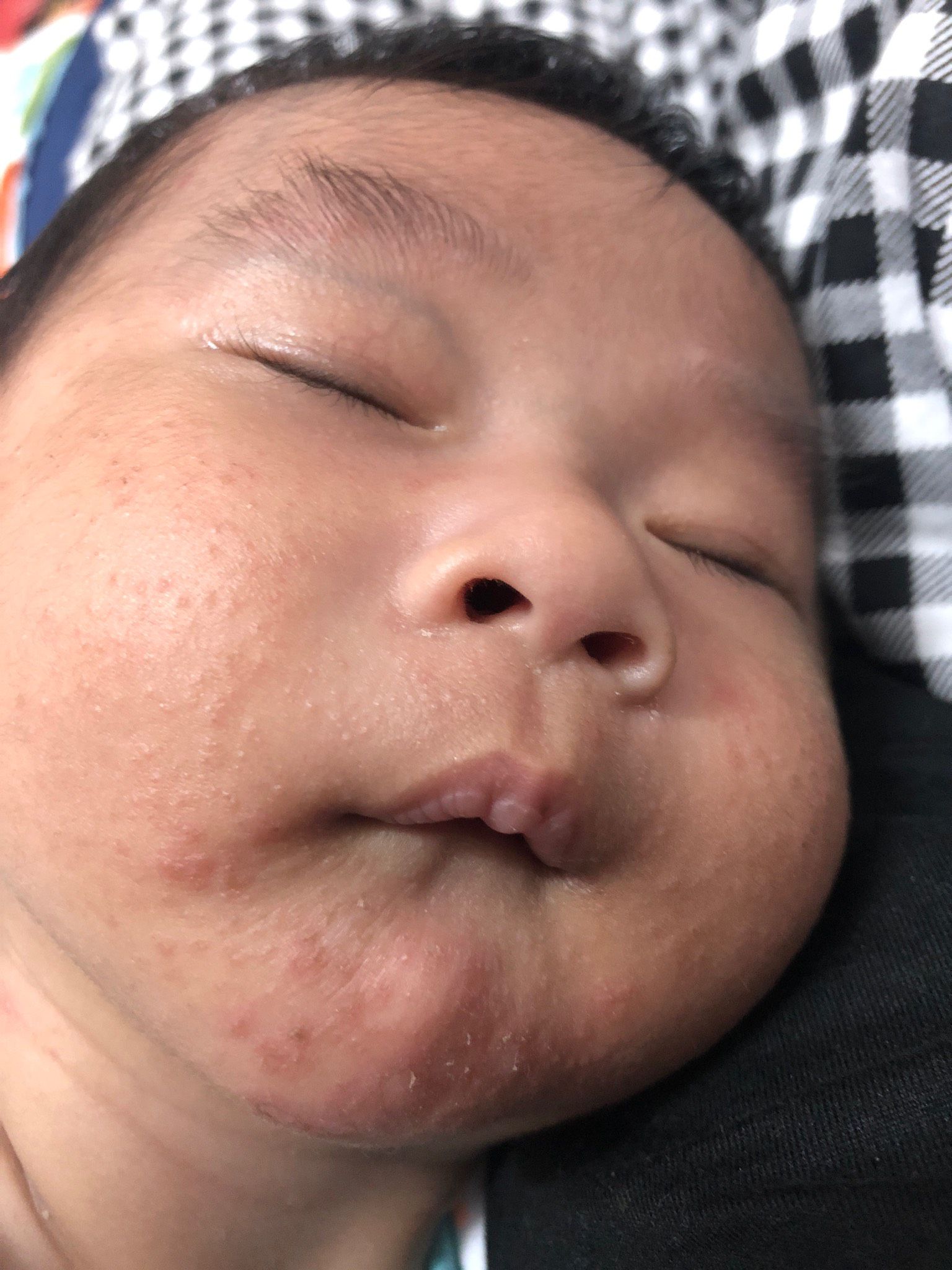皮膚一粒一粒的