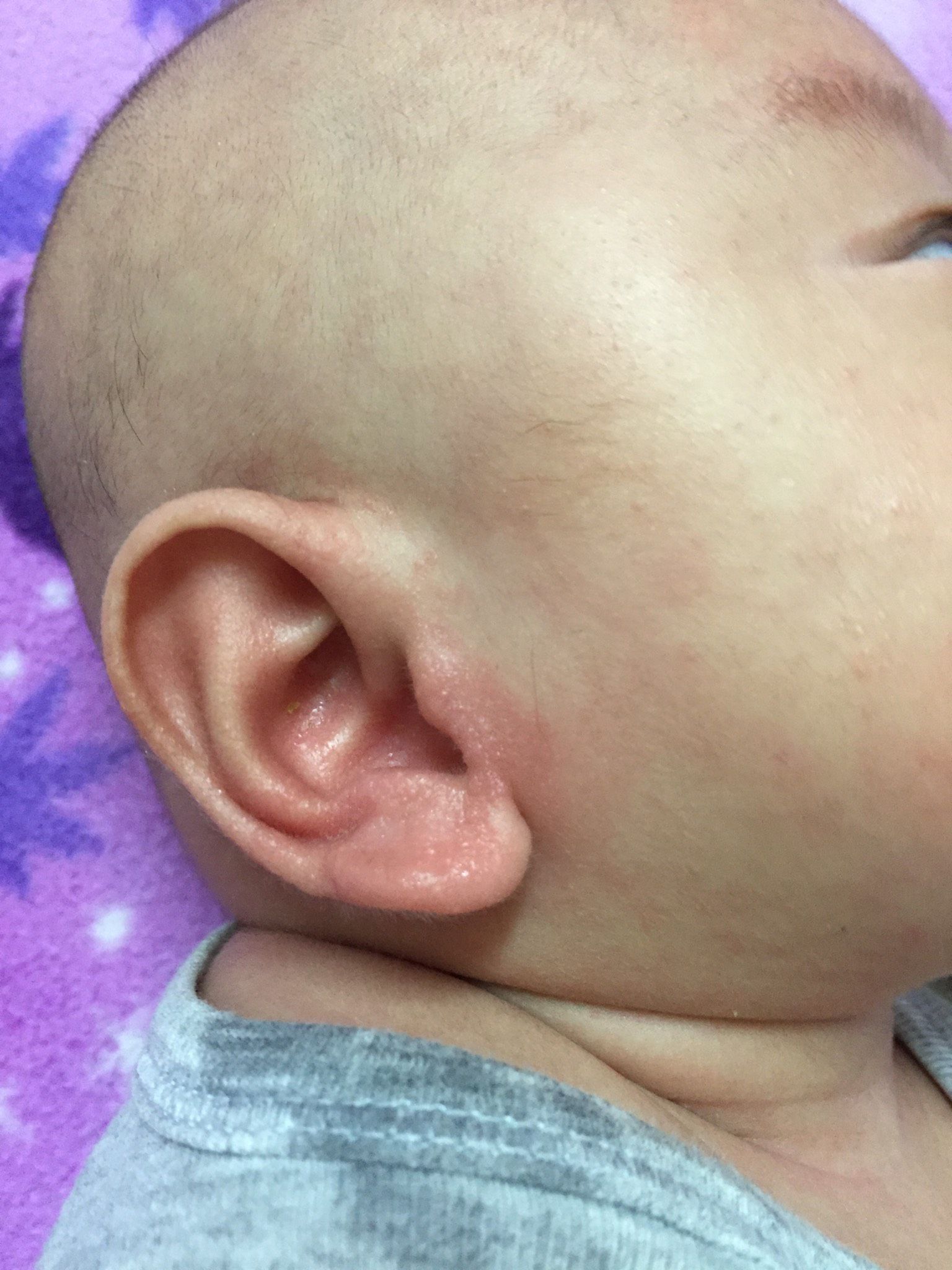 耳朵很紅摸起來乾乾粗粗的