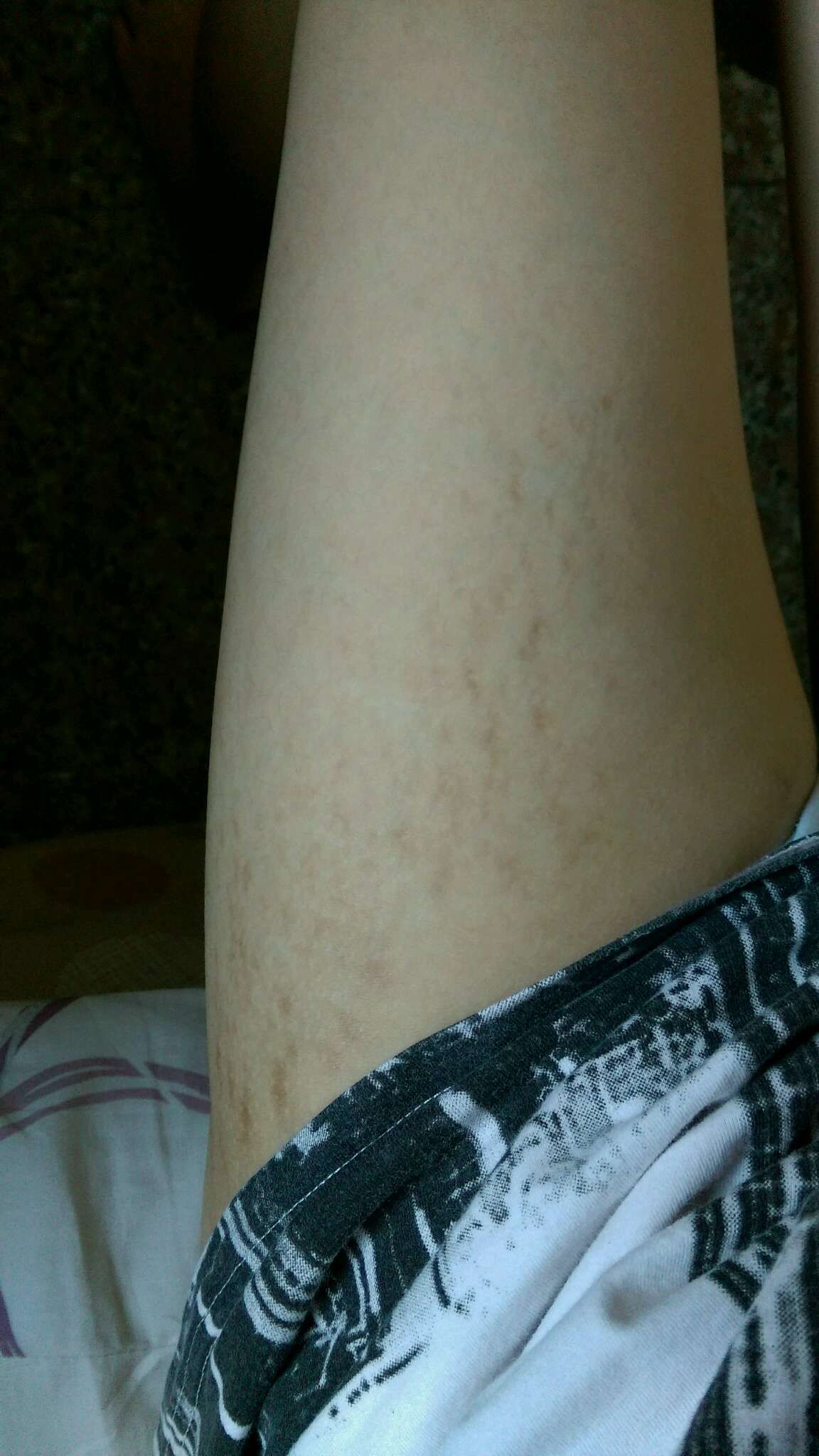 大腿的紋路(血管?)