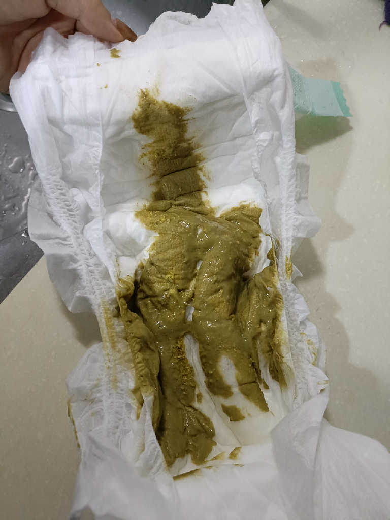 綠色糊狀大便