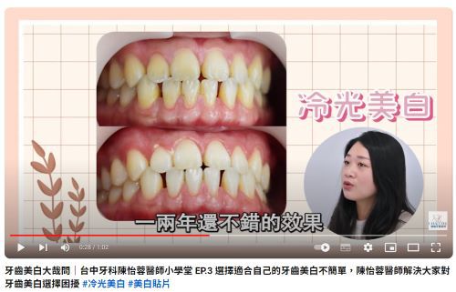 產後可以牙齒美白嗎