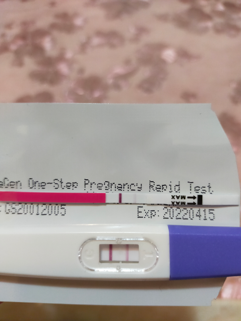 我會不會子宮外孕