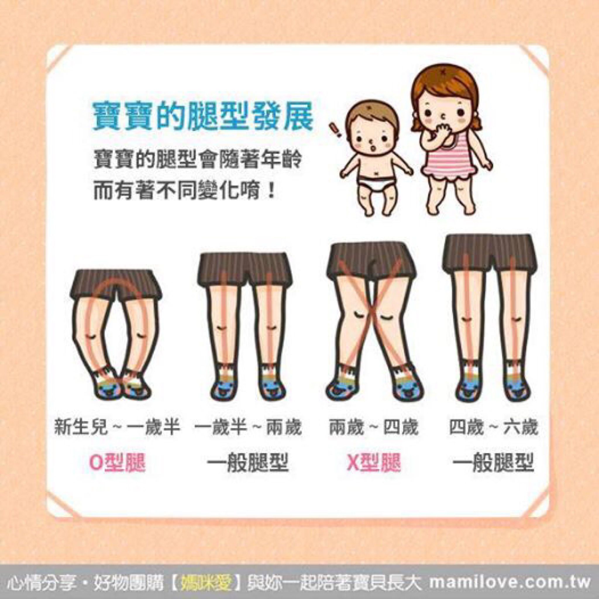 你家寶貝的腿型是哪種?