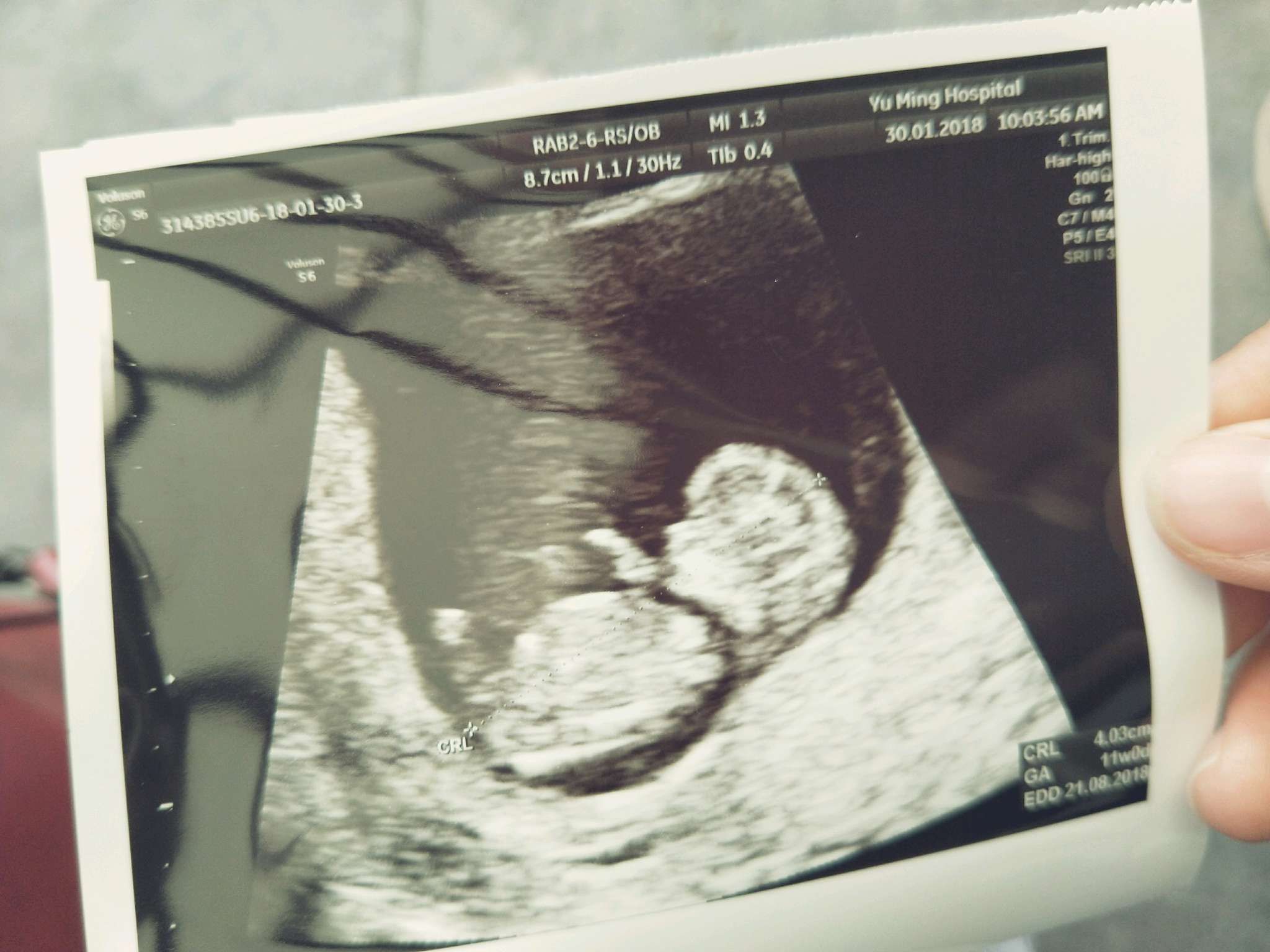 預產期都怎麼算-想吐都吃不下