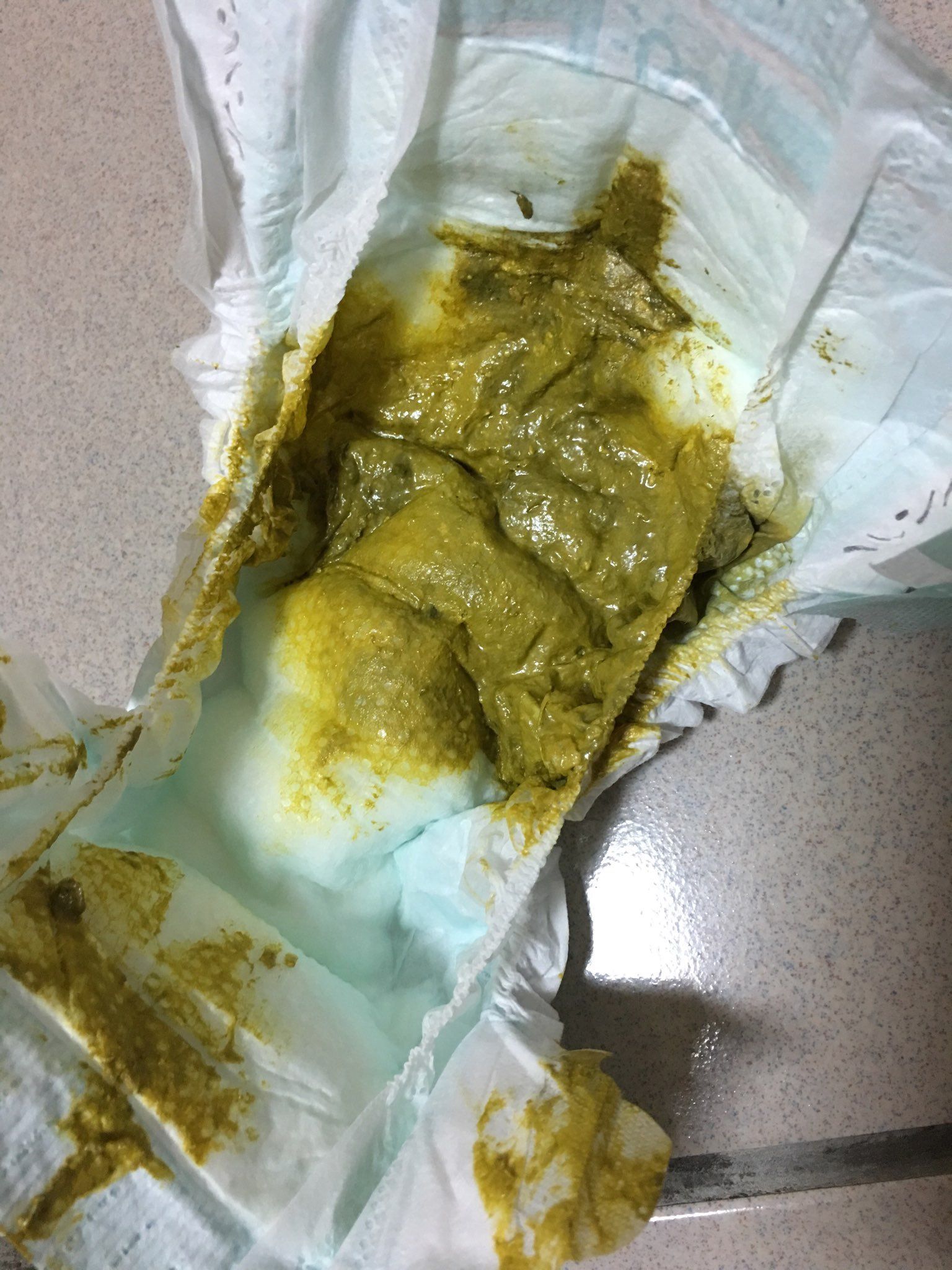 大便顏色有點黑