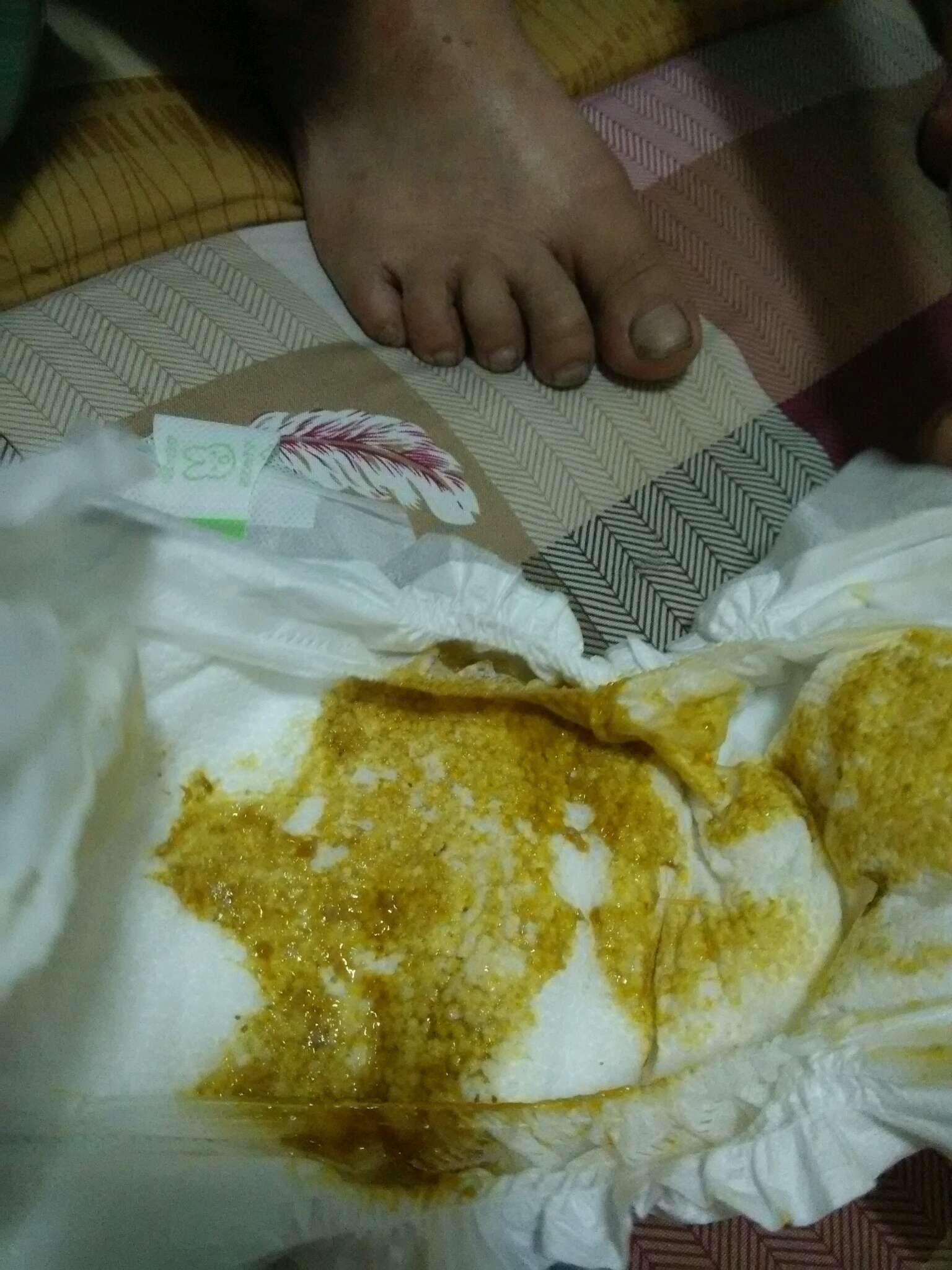 寶寶便便拉稀是正常嗎？