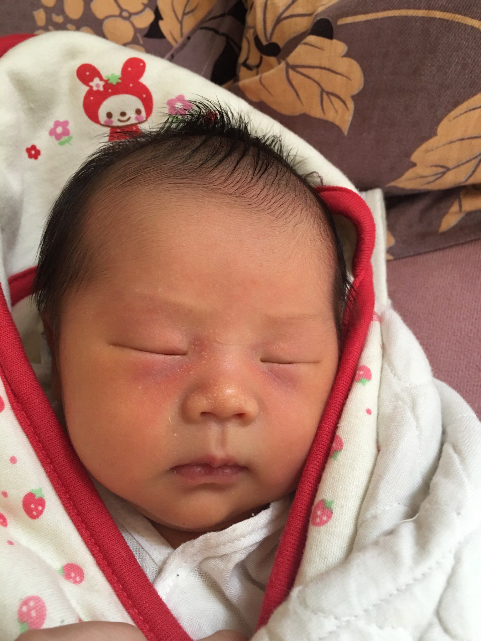 關於新生兒臉紅