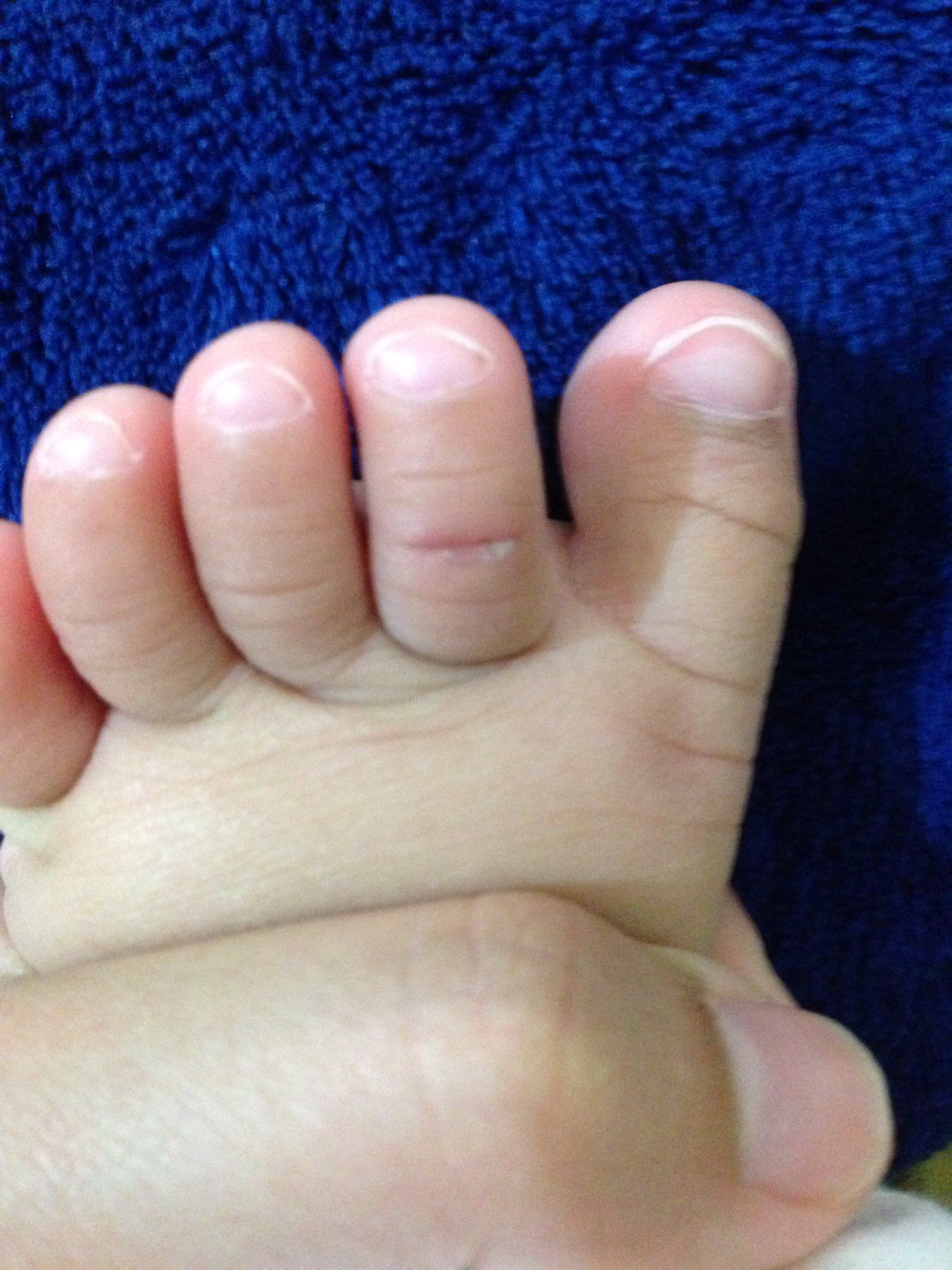 緊急！寶寶腳受傷該怎做！