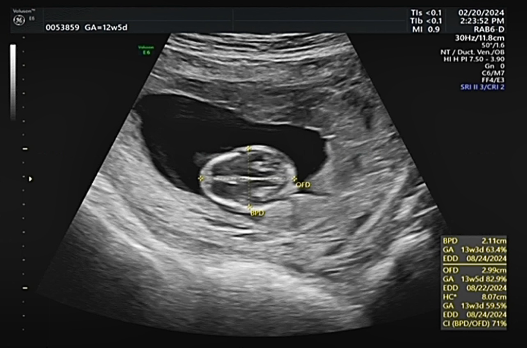 13週高層次 週數
