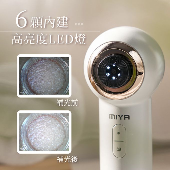 MIYA - 美肌日記 HD 極淨冷熱敷粉刺機-MY-WF120