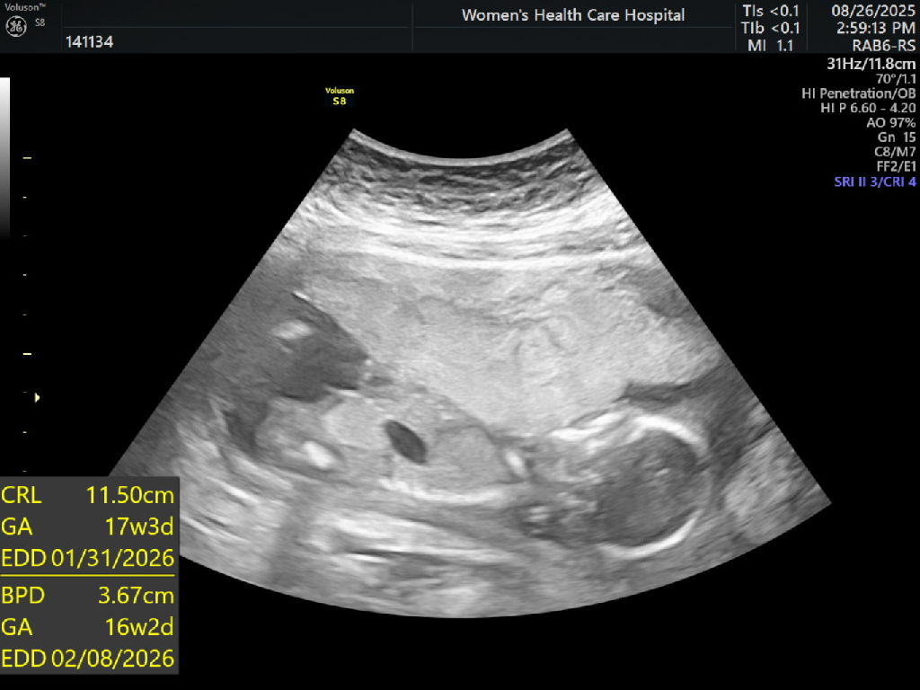 nipt報告醫生會知道性別嘛