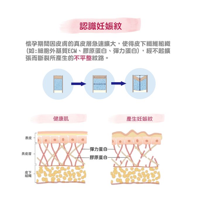 德國珊諾sanosan - S孕女神寵愛孕肌抗紋組-植萃抗紋護理油+膠原彈力抗紋霜