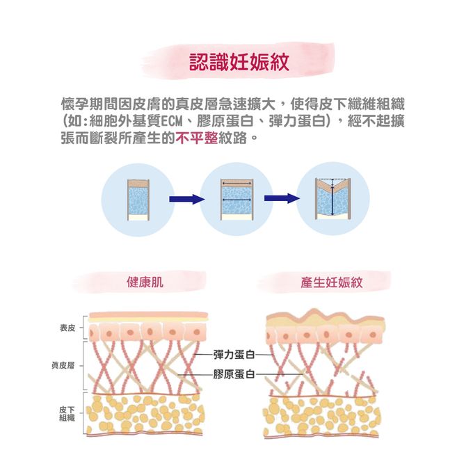 德國珊諾sanosan - S孕女神多胜肽緊緻撫紋霜-30ml