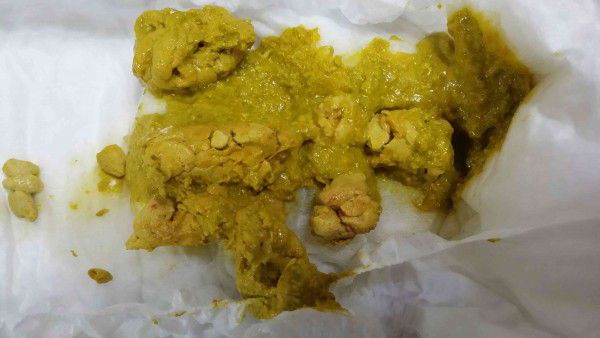 小寶貝便秘了嗎？大便有血絲!