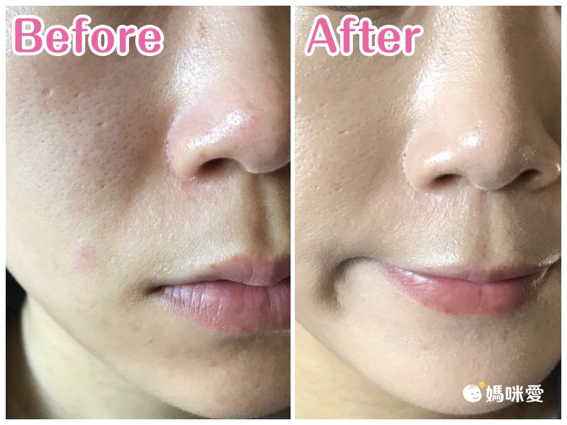 打造無瑕光澤肌！韓國 Age 20's 爆水粉餅