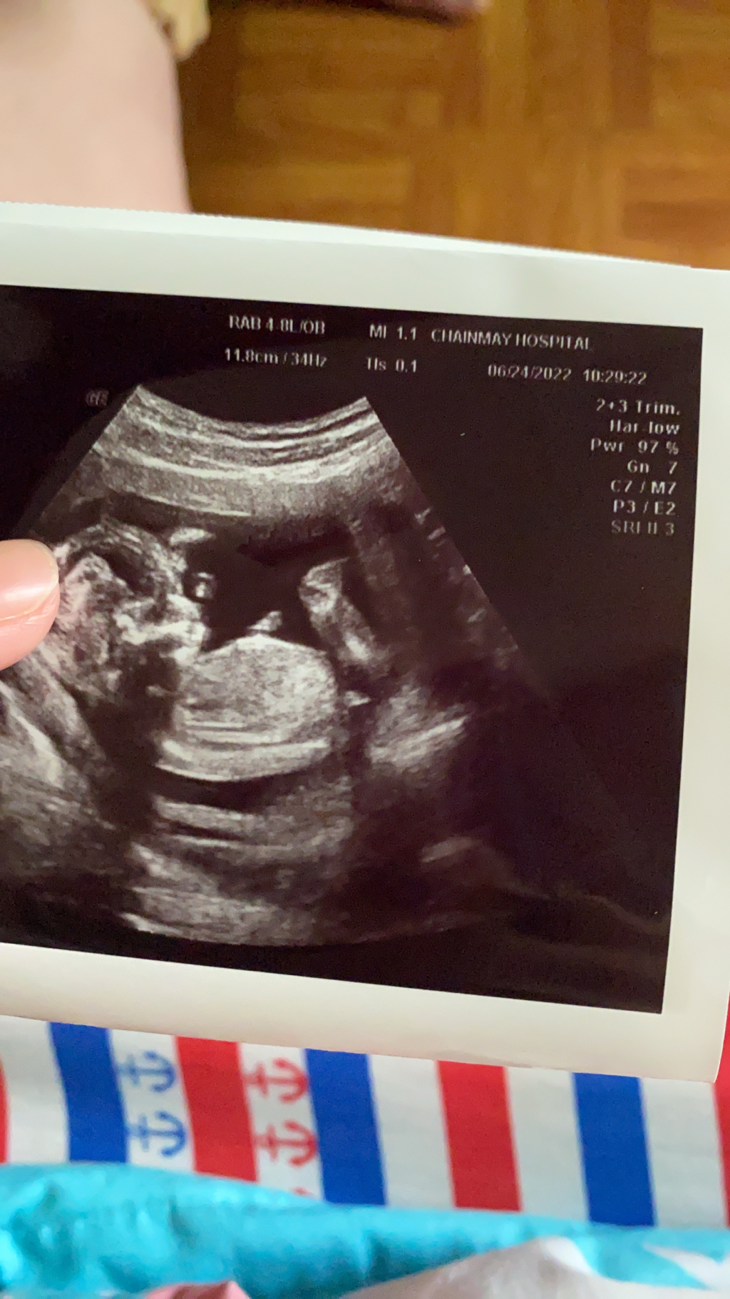 15週產檢 想知道是男寶還是女寶