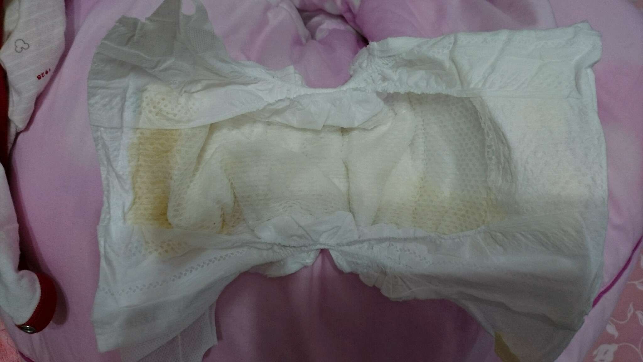 請問這個尿尿是茶色的嗎？