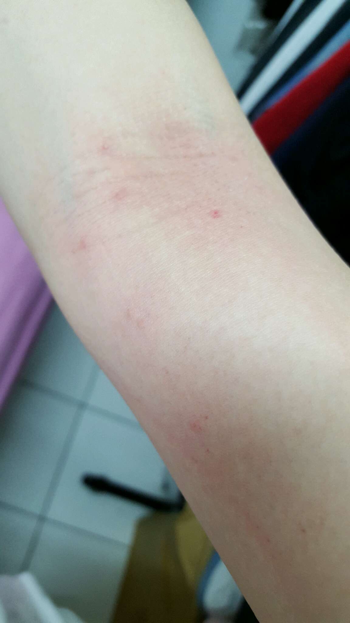 全身都是紅紅一顆一顆的……