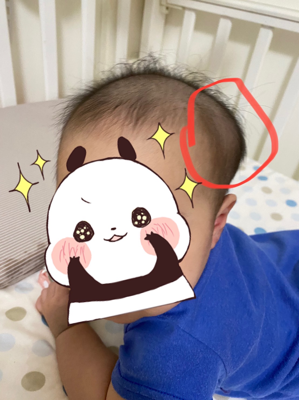 寶寶的頭異常凸起