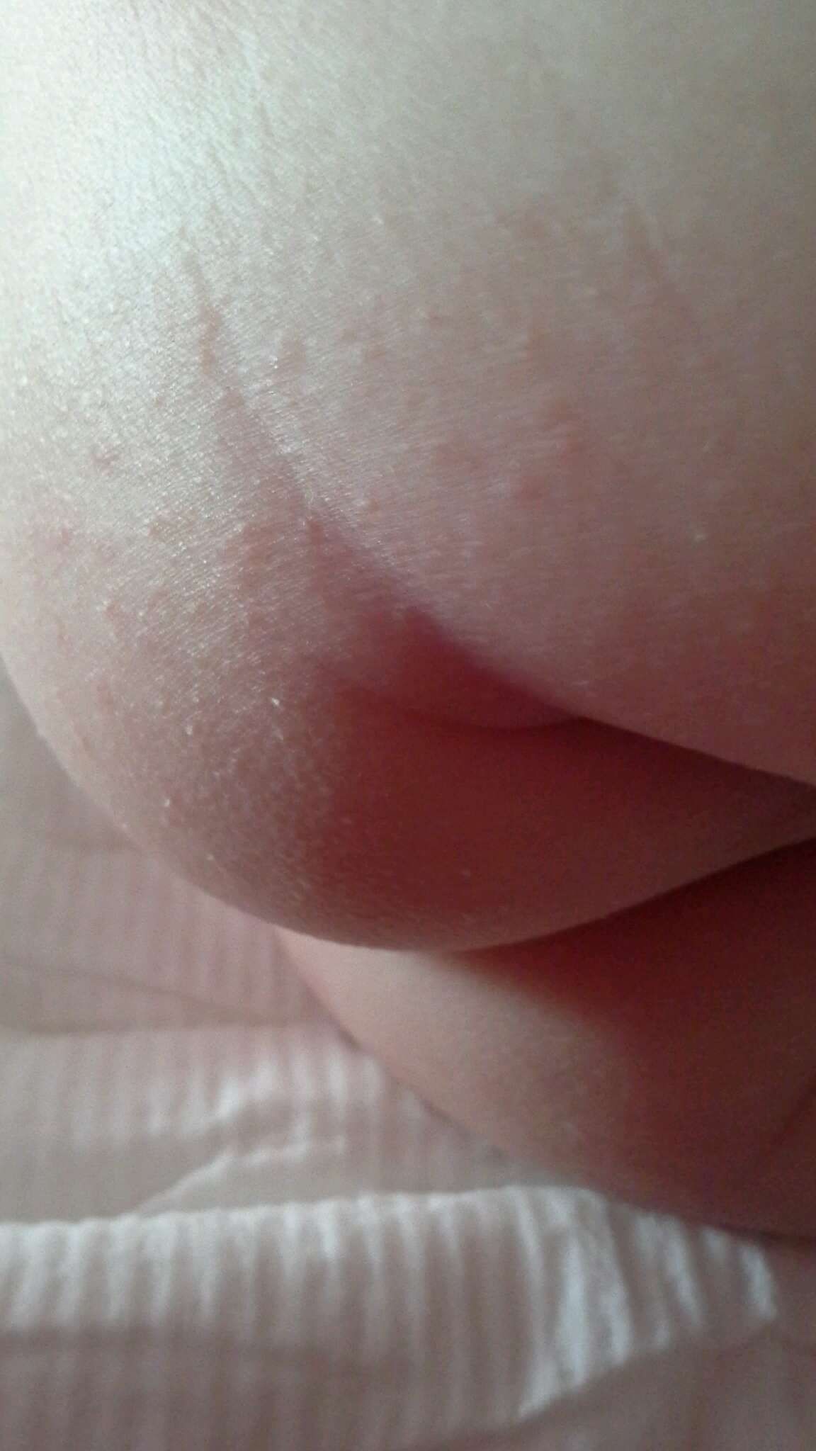 屁屁一顆一顆的