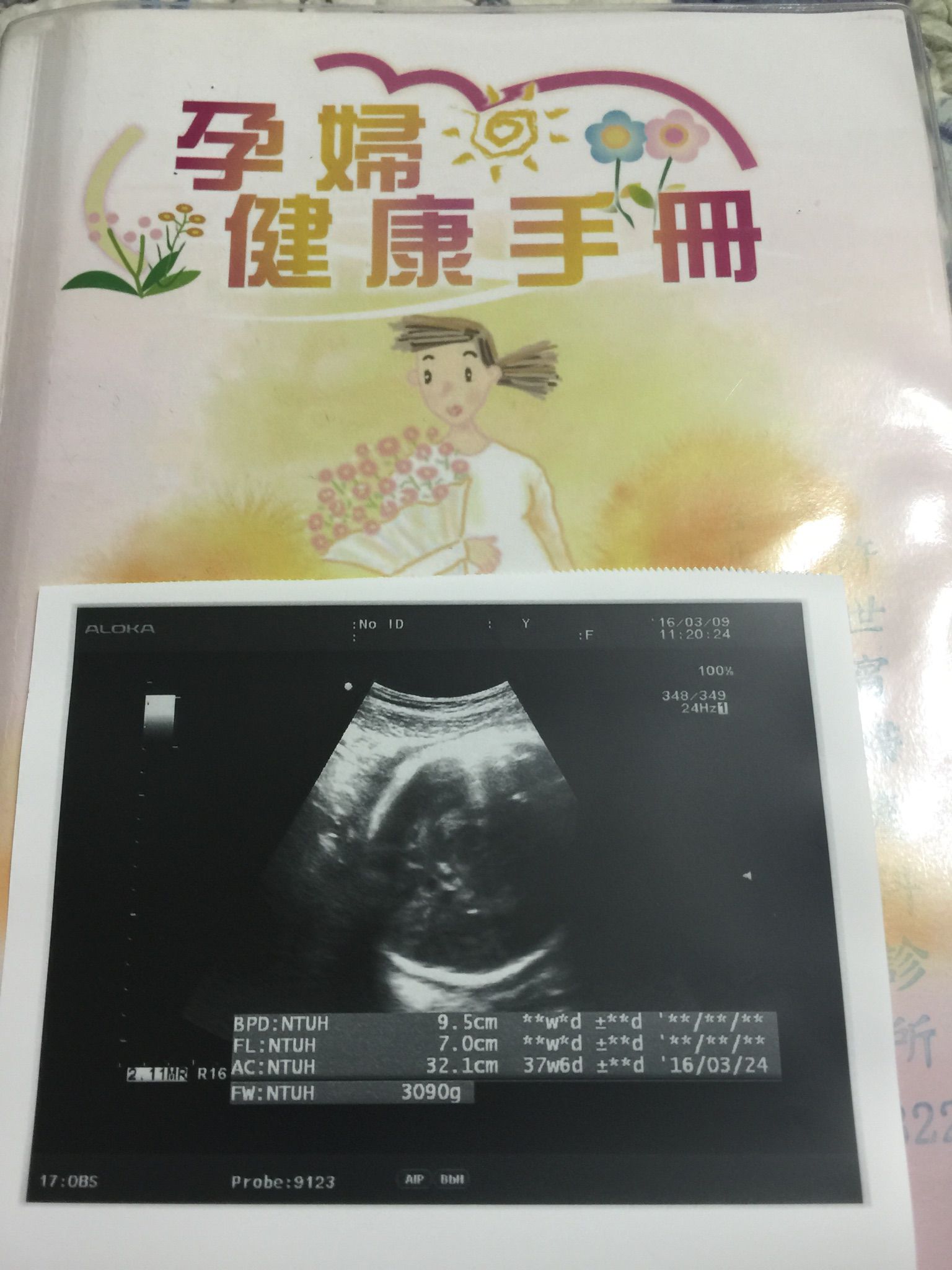 38週+6天了～擔心！