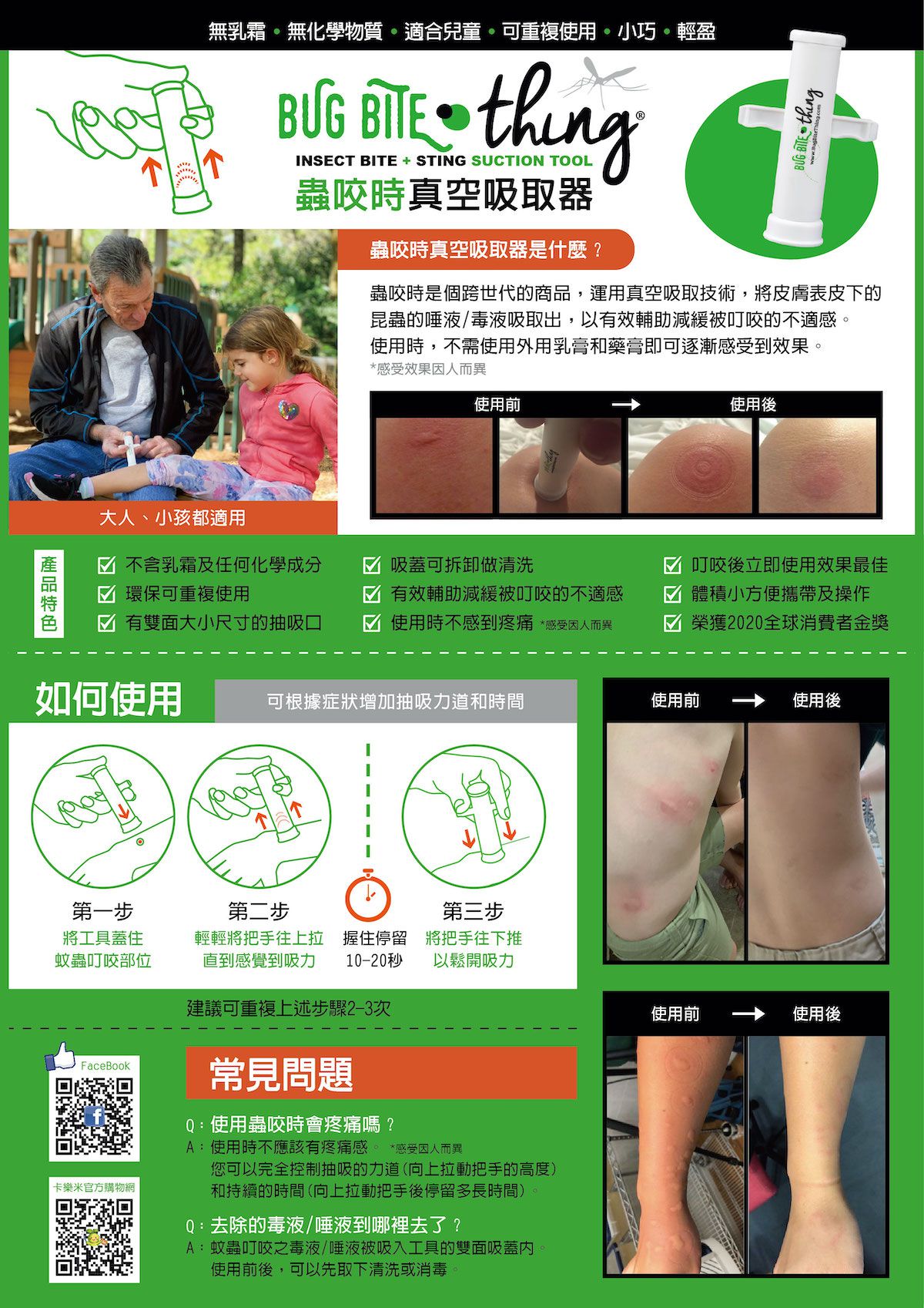 Bug Bite Thing - 蟲咬時真空吸取器(未滅菌)-黑色