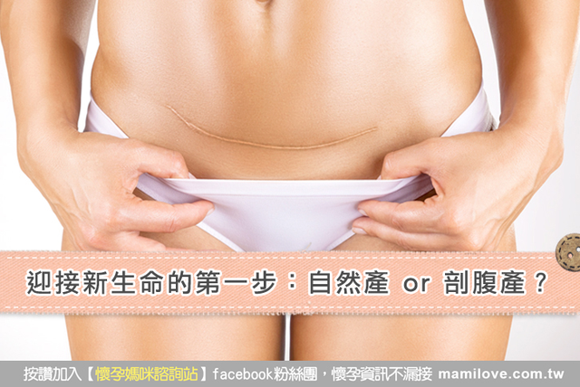 迎接新生命的第一步：自然產 or 剖腹產？