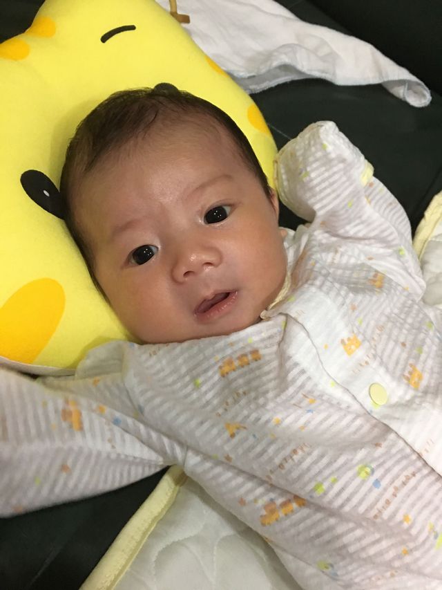 好了之後的臉！
我兒子11號滿月