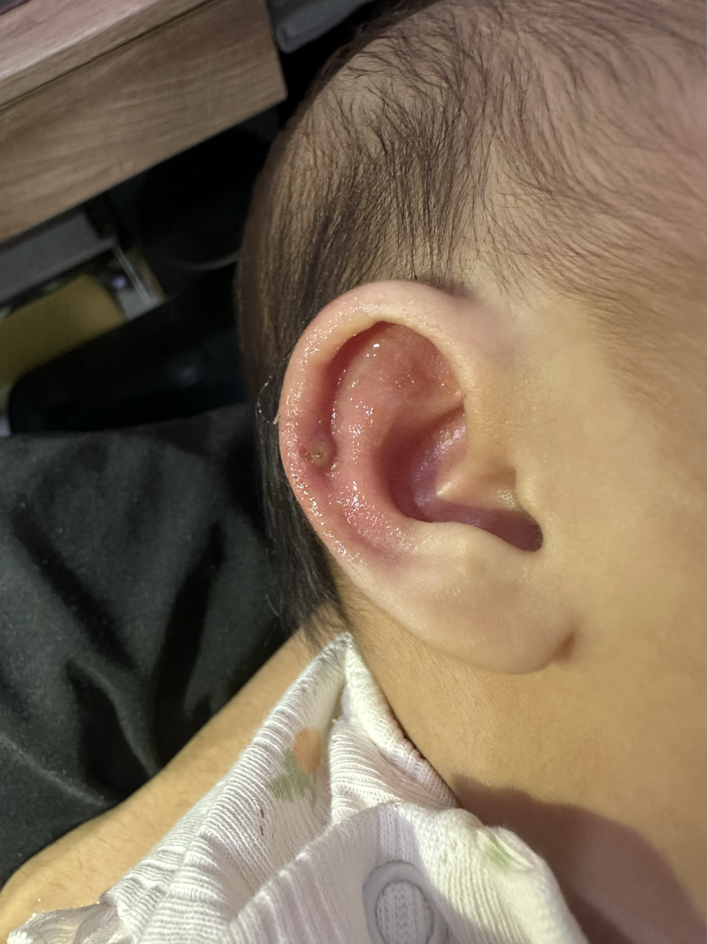 耳朵長一顆，怎麼了